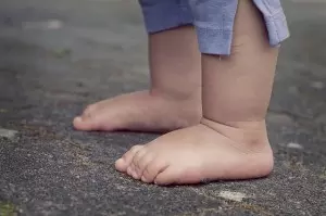 ¿Se pueden prevenir los pies planos?