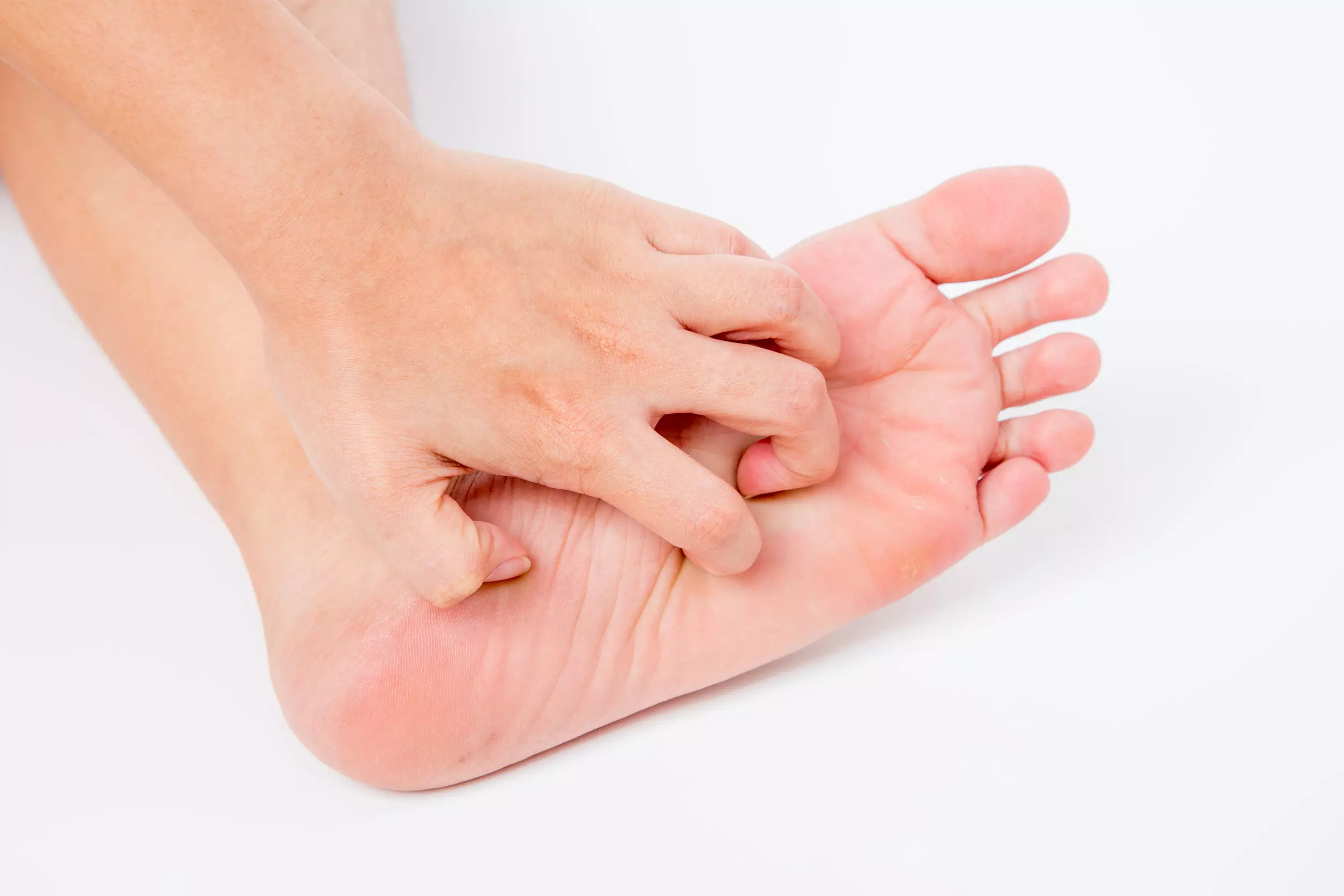 Los eczemas en los pies